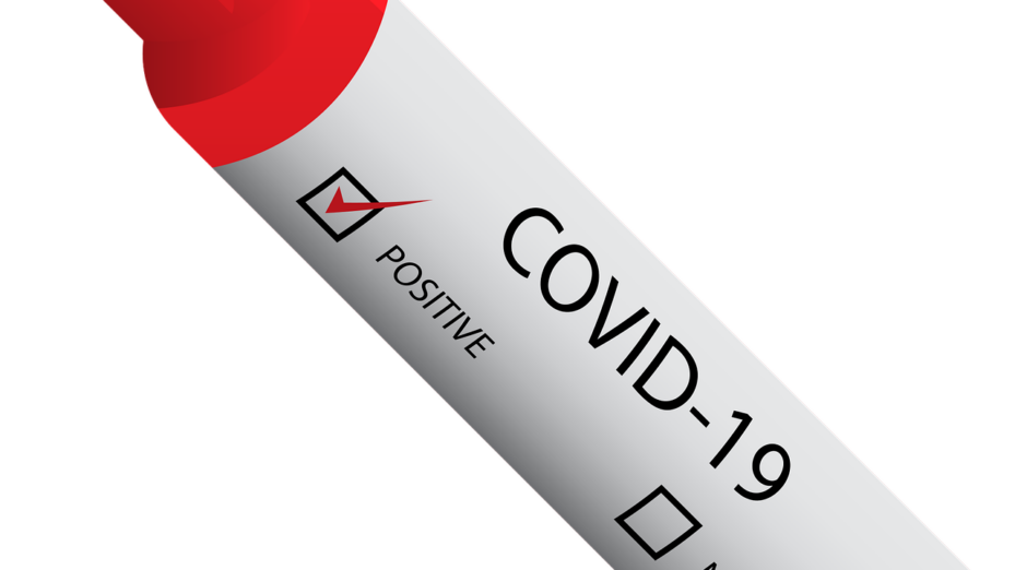 test positif covid 19