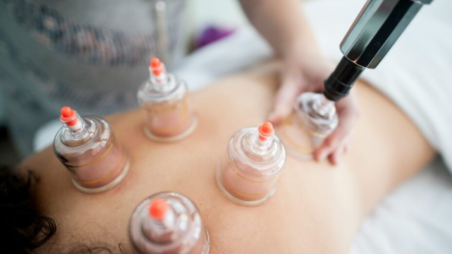 Hijama ventouses médicales