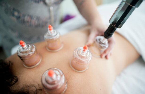 Hijama ventouses médicales